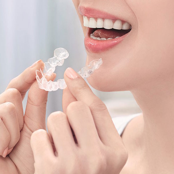 矯正治療イメージ